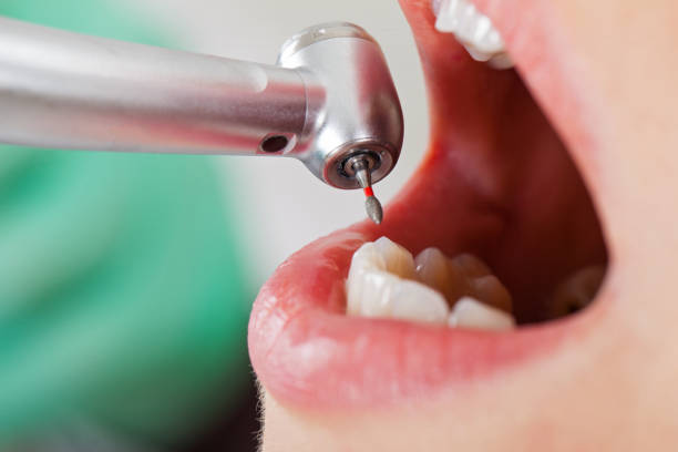 Best Emergency Treatment for Toothache in Guttenberg, IA